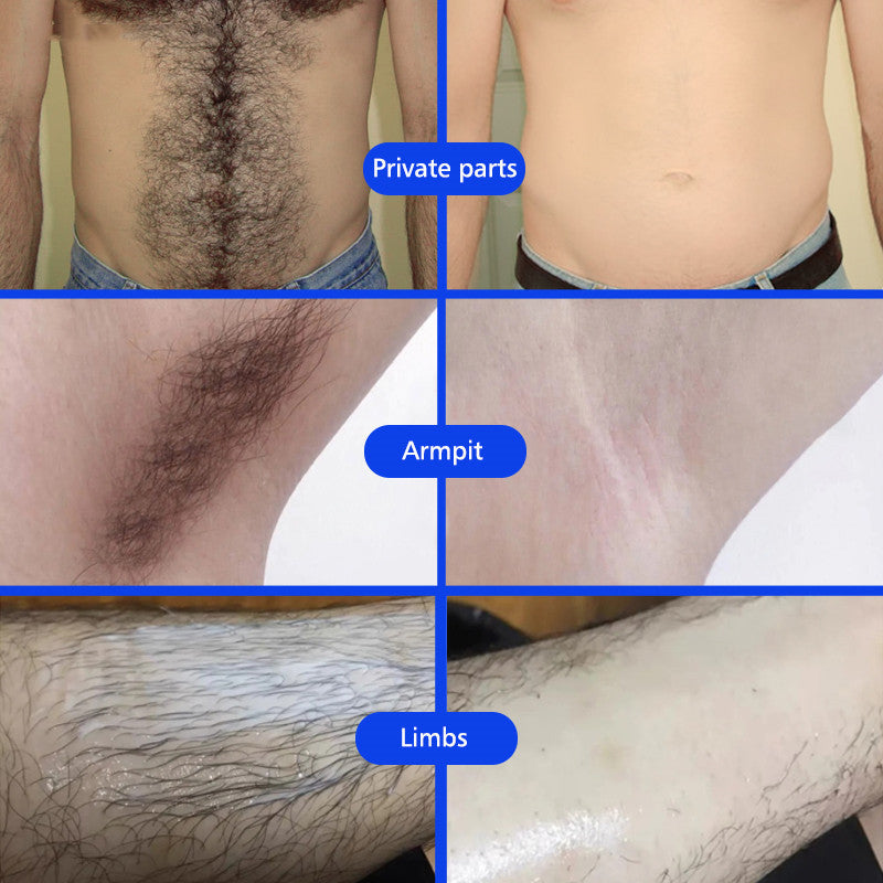 Underarm And Leg Skin Care Cream For Men And Women Ooho