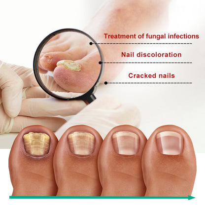 OUHOE Nail Care Nail Soft Nail Care Daily Cleansing Gentle Care Moisturizing Bright Nail Care Solution Ooho