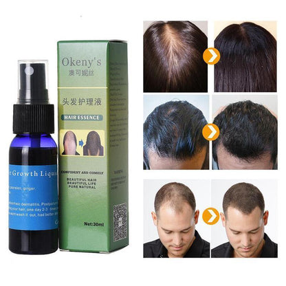 Sunburst Hair Growth Products for women&men anti hair loss products Alopecia Baldness beard oil growth Hair growth spray Ooho