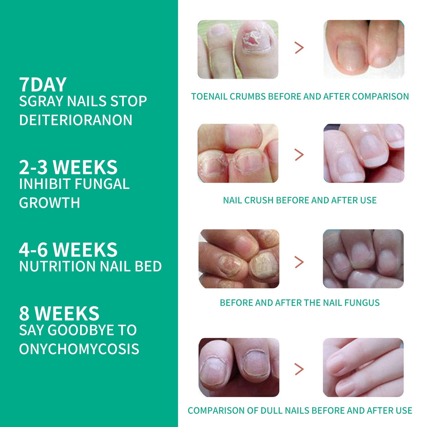 OUHOE Nail Care Nail Soft Nail Care Daily Cleansing Gentle Care Moisturizing Bright Nail Care Solution Ooho