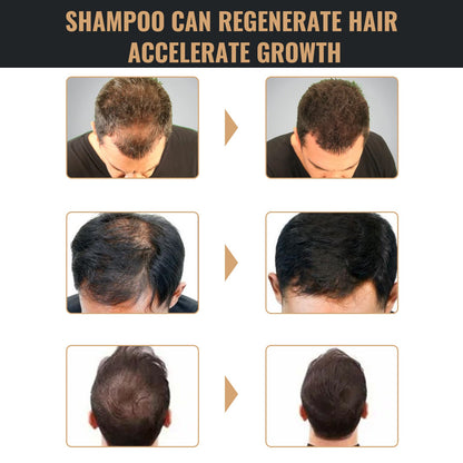 Root Activator Shampoo, Natural Hair Regrowth Shampoos, Unisex Hair Thickening Shampoo, Gently Shampoo For Men & Women, Nourishing Long Lasting Hair Care For Darker & Thicker Hair Ooho