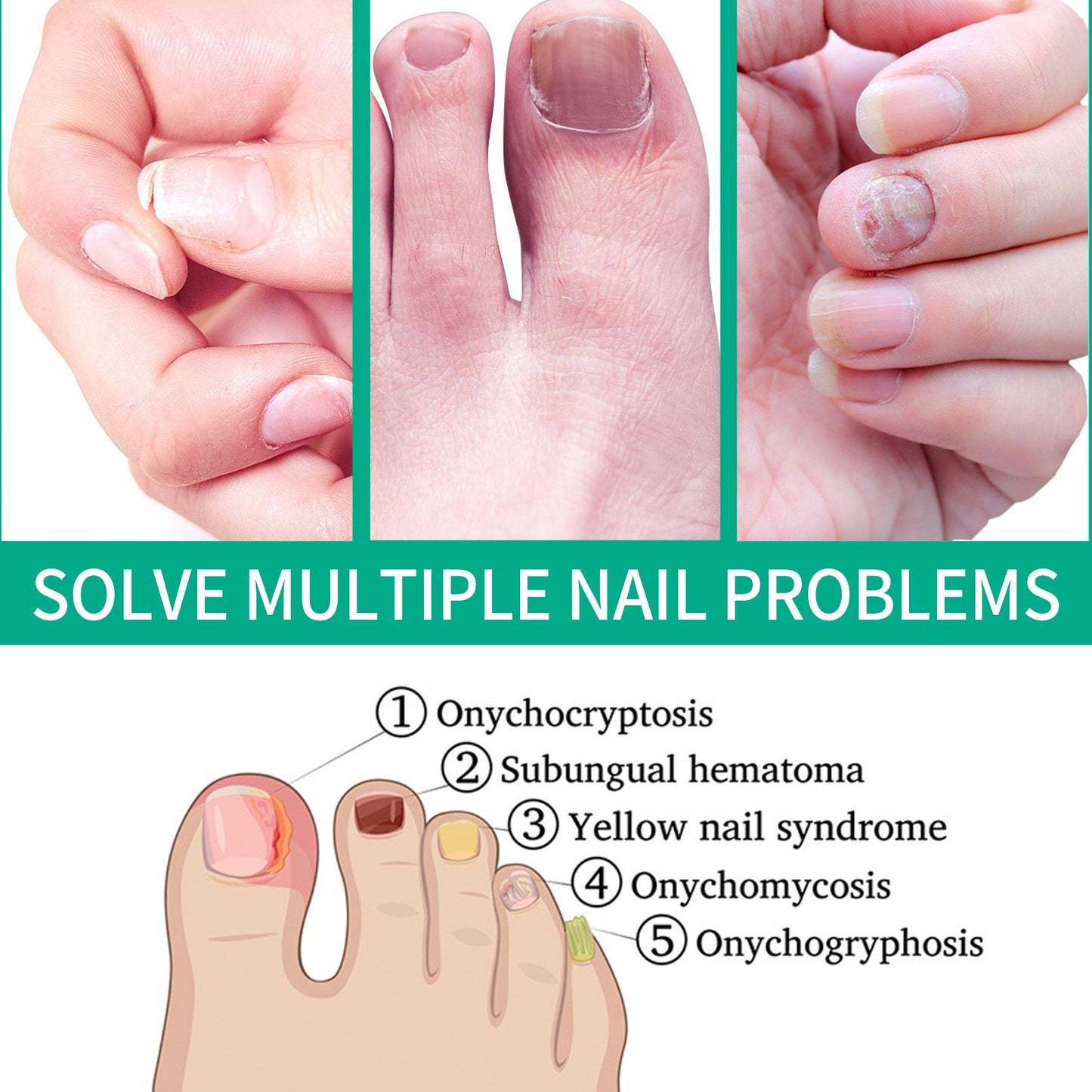 OUHOE Nail Care Nail Soft Nail Care Daily Cleansing Gentle Care Moisturizing Bright Nail Care Solution Ooho