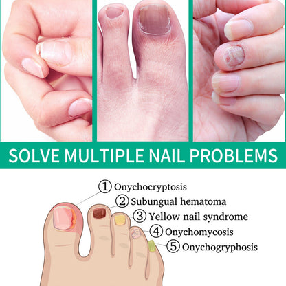 OUHOE Nail Care Nail Soft Nail Care Daily Cleansing Gentle Care Moisturizing Bright Nail Care Solution Ooho