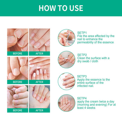 OUHOE Nail Care Nail Soft Nail Care Daily Cleansing Gentle Care Moisturizing Bright Nail Care Solution Ooho