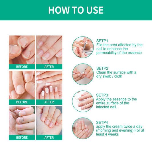 OUHOE Nail Care Nail Soft Nail Care Daily Cleansing Gentle Care Moisturizing Bright Nail Care Solution Ooho