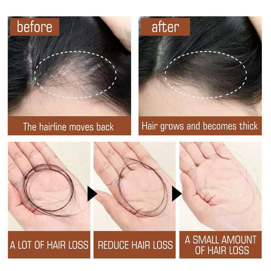 Batana Oil From Honduras - Get Fuller, Thicker, Healthier Hair - Great Gifts For Women  Men Conditioner Haircare Silky - Hair Nutrition Ooho
