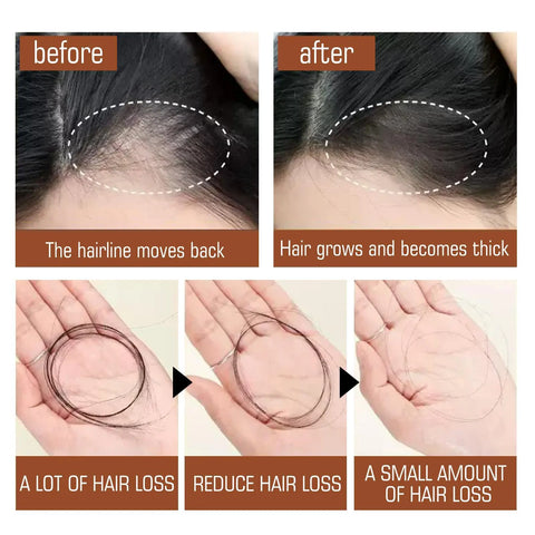 Batana Oil From Honduras - Get Fuller, Thicker, Healthier Hair - Great Gifts For Women  Men Conditioner Haircare Silky - Hair Nutrition Ooho