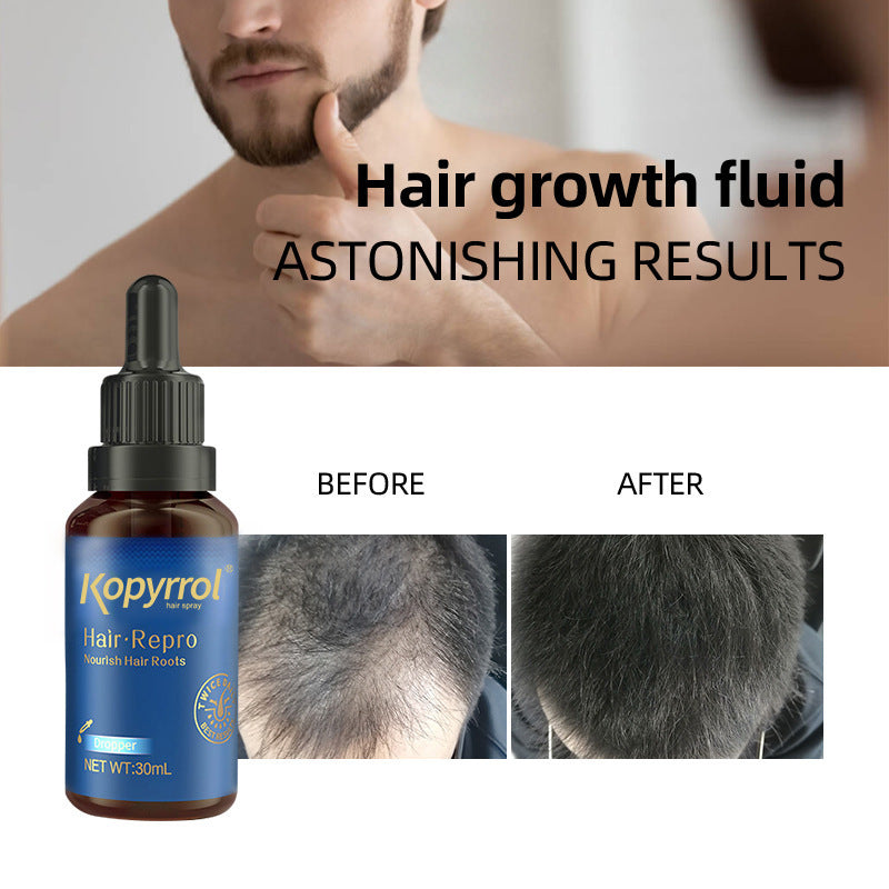 Hair-care Lotion For Men And Women's Hairline Ooho