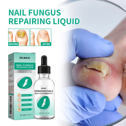 OUHOE Nail Care Nail Soft Nail Care Daily Cleansing Gentle Care Moisturizing Bright Nail Care Solution Ooho